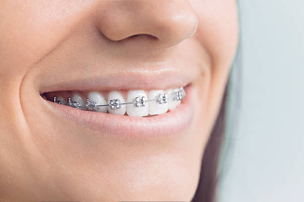 Best General Dentistry  in Plymouth, IN